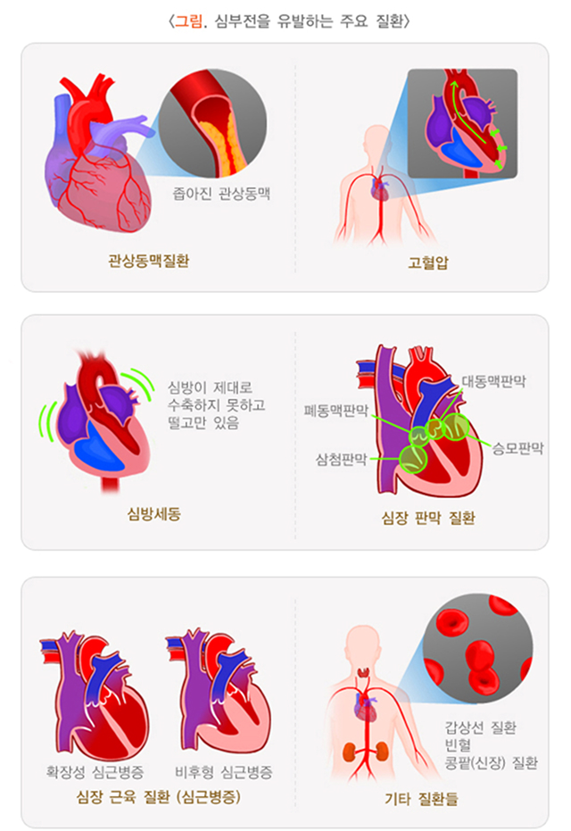 심장 이미지