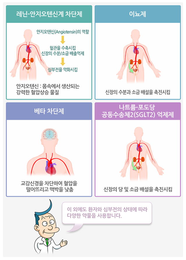 심부전 상태에 따른 약제 복용 이미지