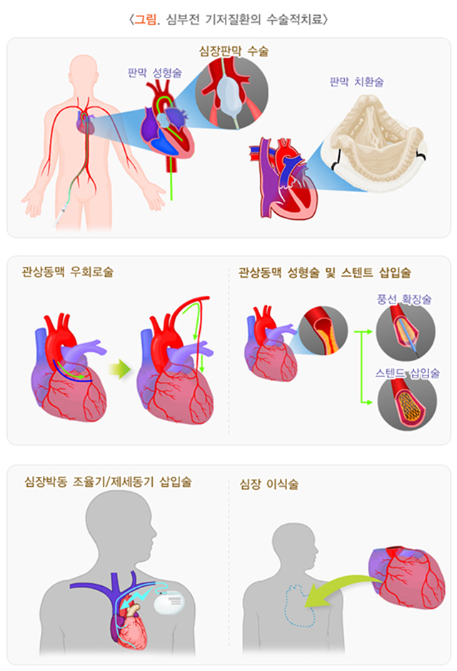 심장 이미지